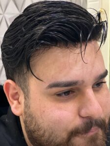 پروتز مو با تراکم بالا,ماندگاری پروتز مو پروتز موی آقایان,پروتز مو با تراکم بالا,پروتز موی بانوان,پروتز موی طبیعی,قیمت پروتز مو,پروتز مو دائم